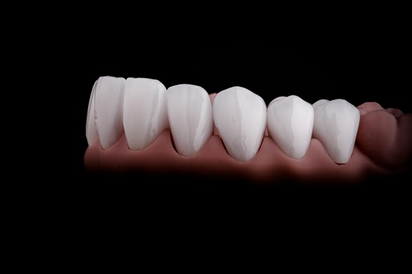 The Dangers Of Smoking With New All On   Implants