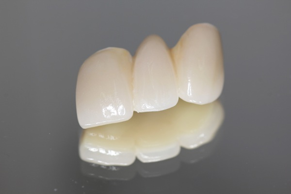 Types Of Dental Bridges And How To Choose The Right One For Your Smile